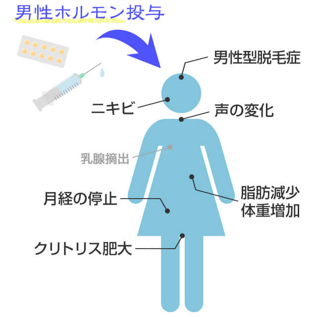 男性化の為にホルモン治療が始まると月経の停止・体重増加・脂肪減少・にきび・声の変化・クリトリス肥大・体毛増加・男性型脱毛症などが起こる