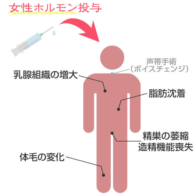 女性化の為にホルモン治療が始まると乳腺組織の増大・脂肪沈着・体毛の変化・精巣の萎縮・造精機能喪失などが起こる