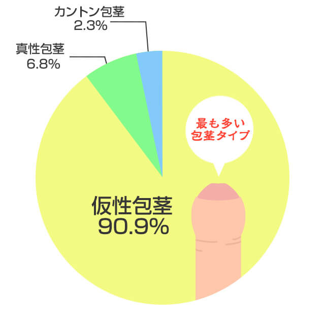 包茎男性の90％以上が仮性包茎で亀頭が刺激に弱く早漏になる