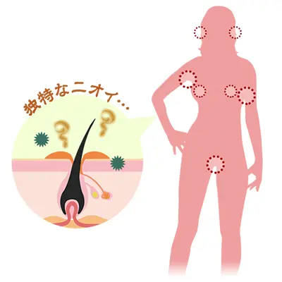 デリケートゾーンのニオイについて