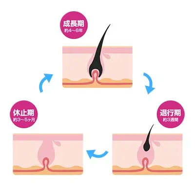 出産後の抜け毛の原因や対処方法