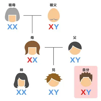 遺伝ハゲについて