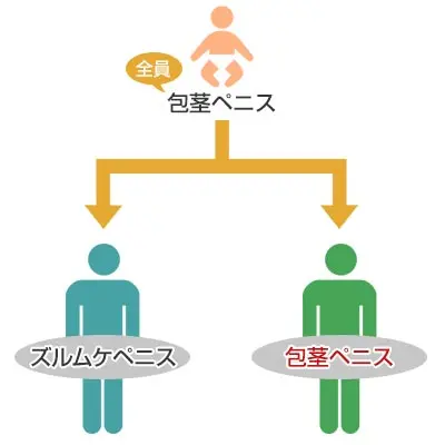 包茎と早漏の関連性