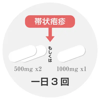 帯状疱疹